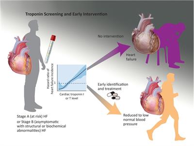 Preclinical screening for cardiovascular disease with high-sensitivity cardiac troponins: ready, set, go?